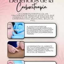 Beneficios de la carboxiterapia