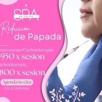 Promoción reducción de papada