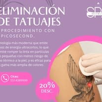 Promoción eliminación de tatuajes
